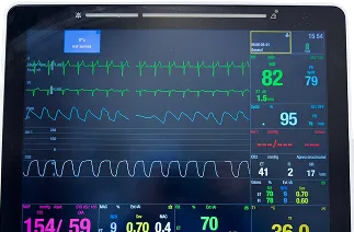 Cardiology Chart Trend Analyzer